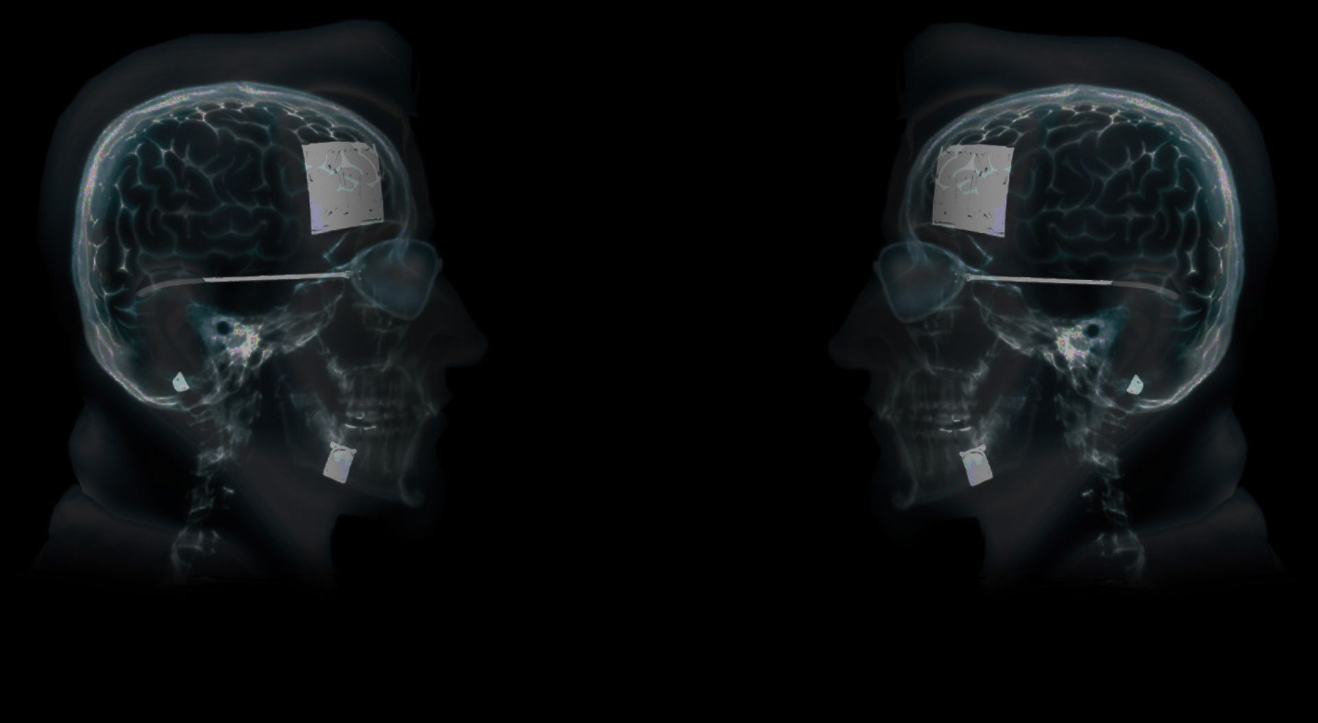 Discovery splash banner for LarpZone (Undergoing Revamps) Discord server